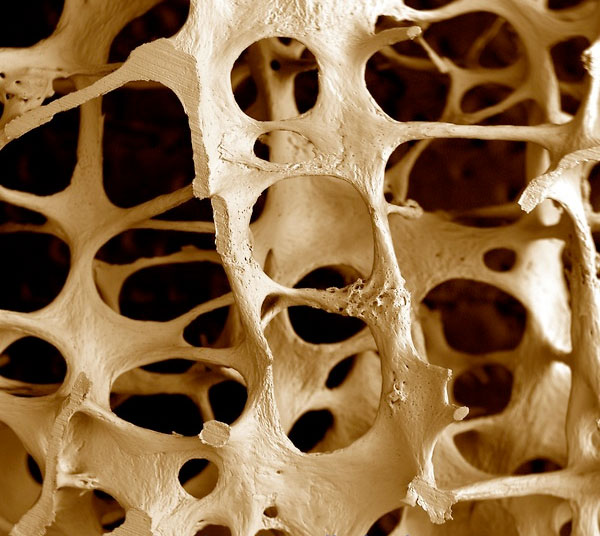 Osteoporose - orthomannheim.de